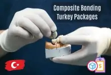 Composite Bonding Turkey Price 98 Composite Bonding Cost and Prices in Turkey