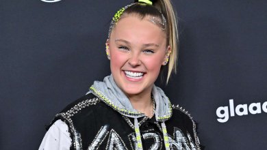 Jojo Siwa Veneers - Before & After 93 jojo siwa veneers dental